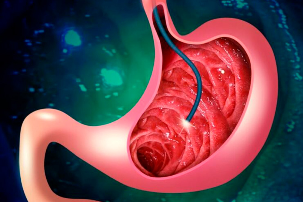 Endoscopia Digestiva